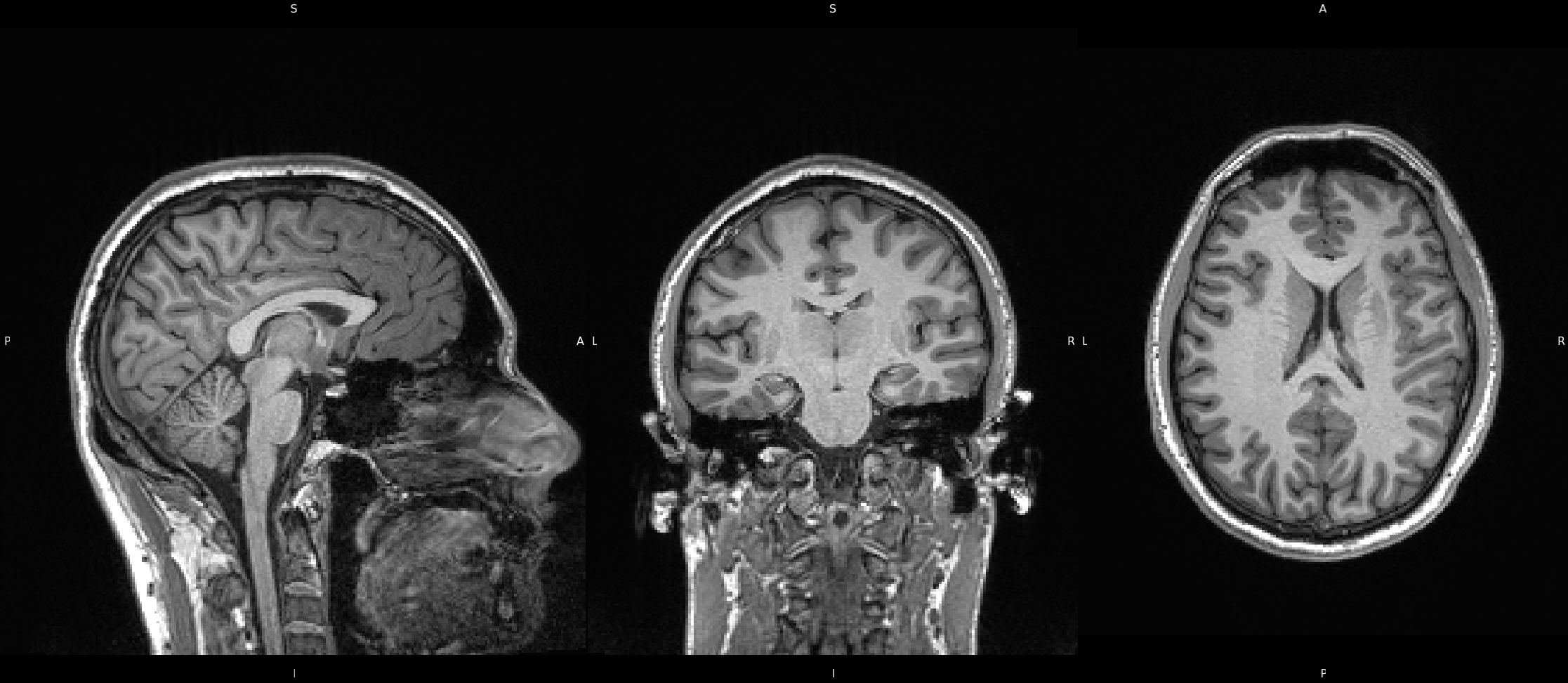 unprocessed brain images