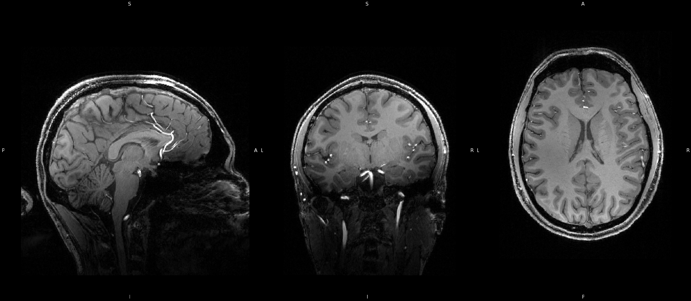 unprocessed brain images